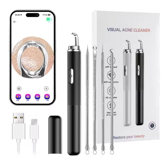 Acne & Blackhead Extraction Remover with HD Camera